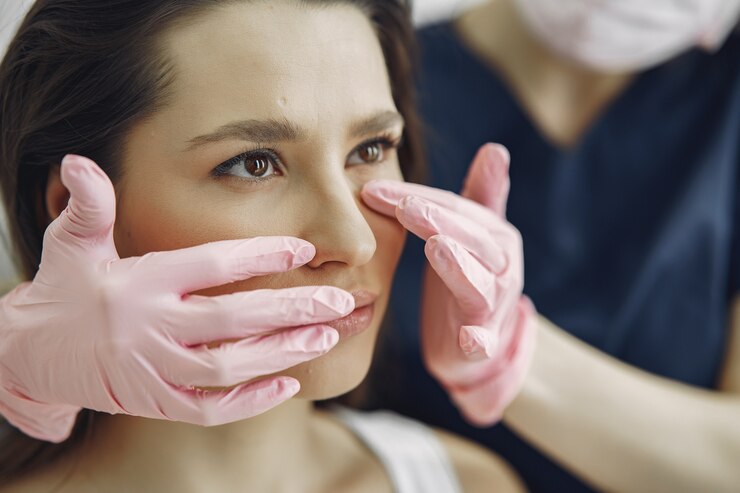 rinoplastia