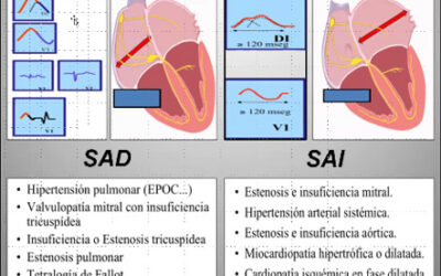Clase 13 – CEB 2025