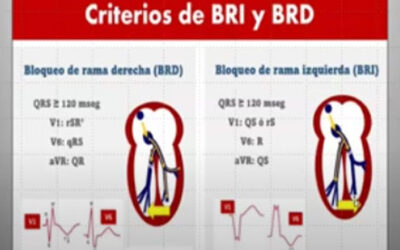 Clase 18 – CEB 2025