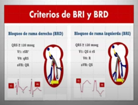 Clase 18 – CEB 2025
