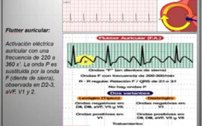 Clase 19 – CEB 2025