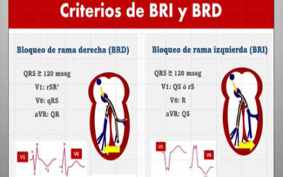 Clase 21 – CEB 2025