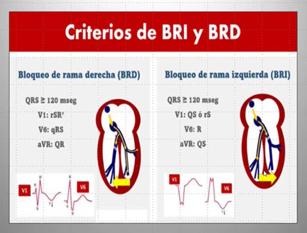 Clase 21 – CEB 2025