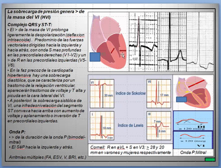 Clase 22 – CEB 2025